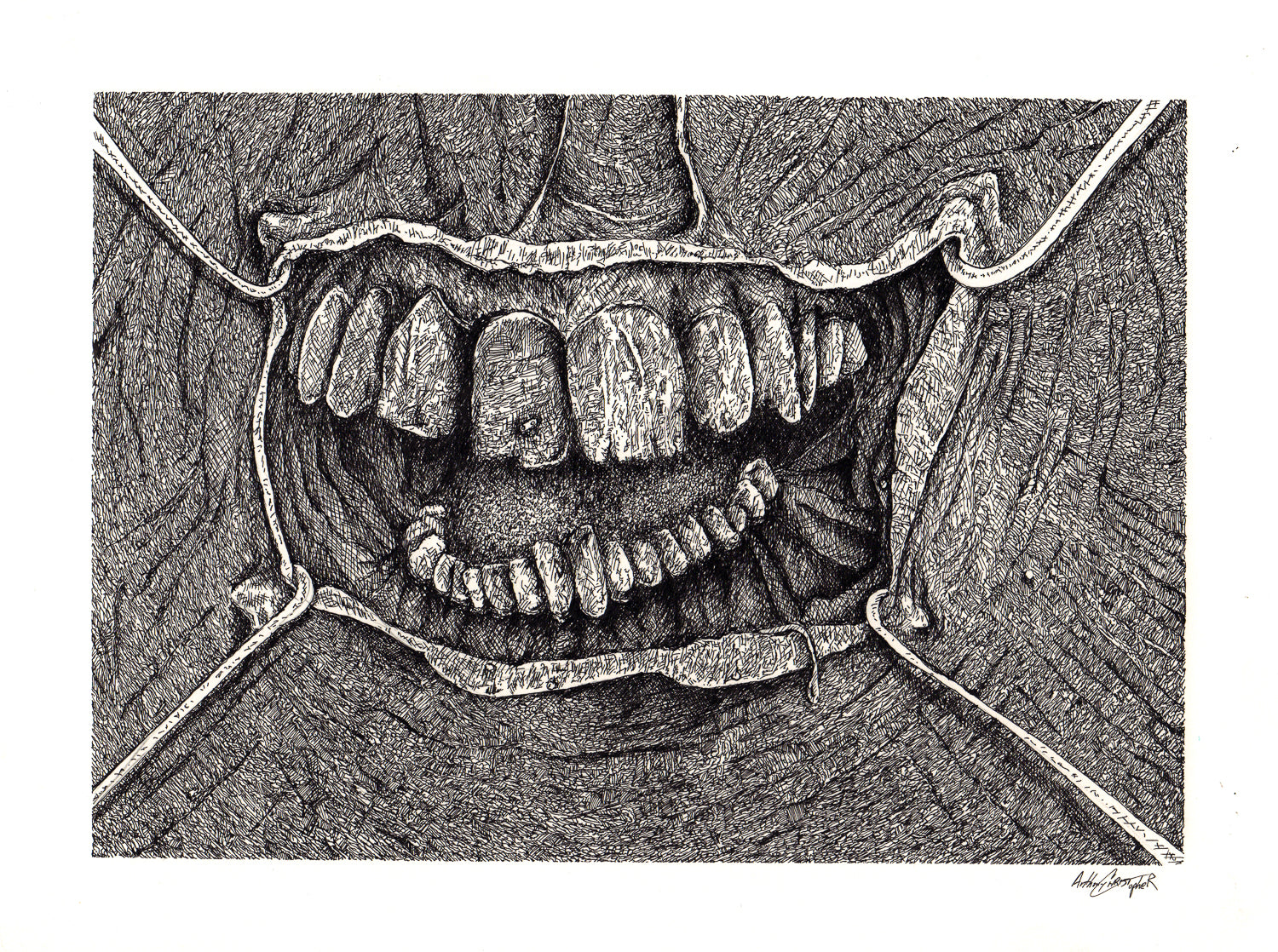 "Teeth" by Anthony Christopher