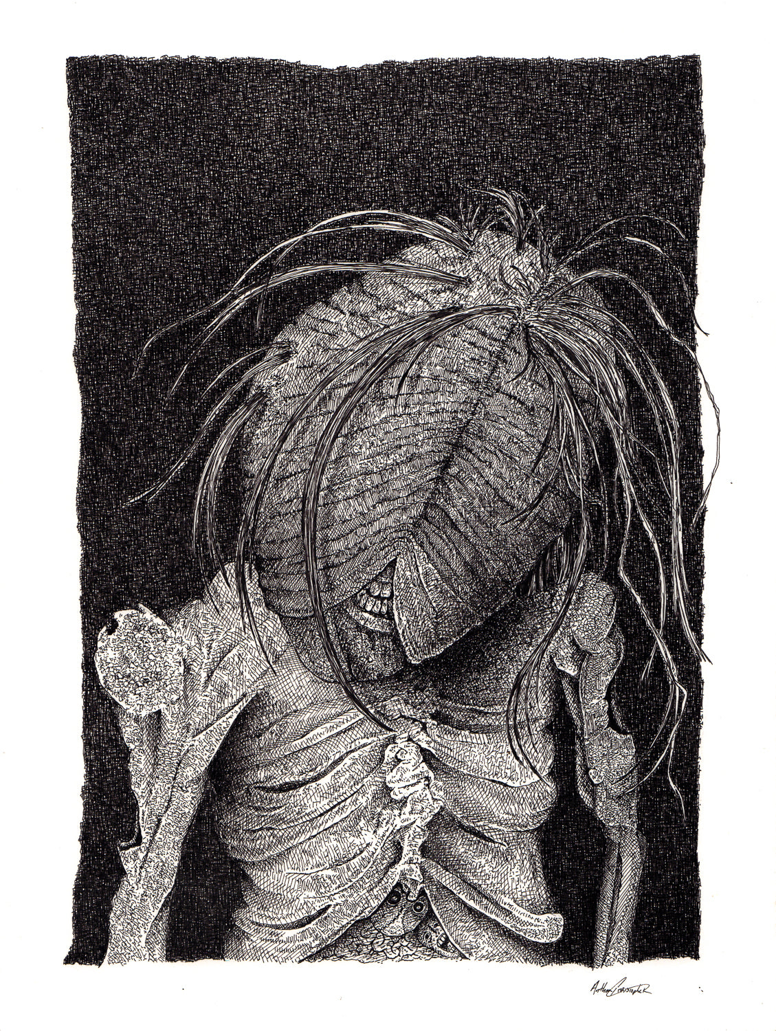 "Trichotillomania (Hair Pulling Disorder)" by Anthony Christopher