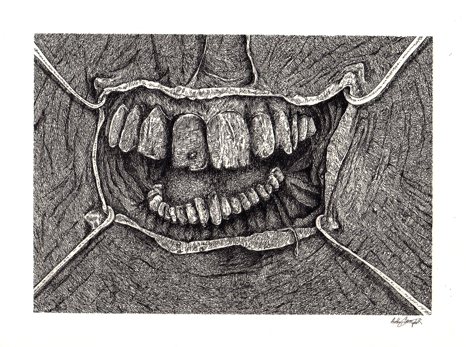"Teeth" by Anthony Christopher